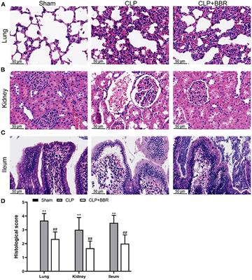 Study on the protective effect of berberine treatment on sepsis based on gut microbiota and metabolomic analysis